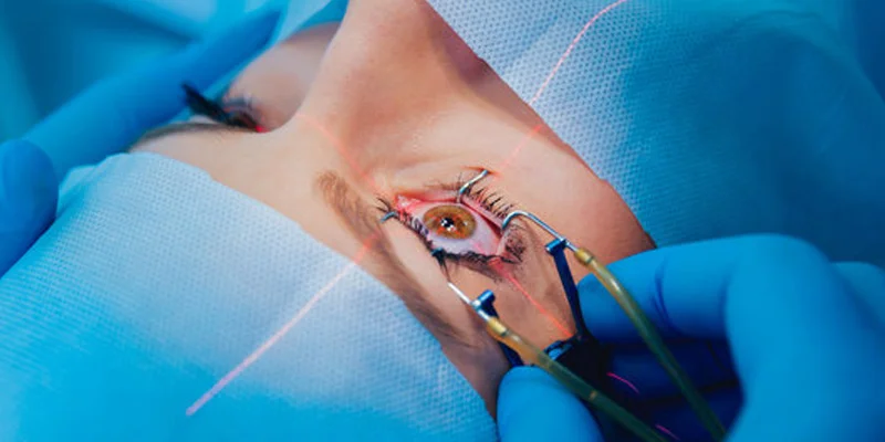 cataract surgery